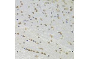 Immunohistochemistry of paraffin-embedded rat brain using DOK1 Antibody (ABIN6130881, ABIN6139763, ABIN6139764 and ABIN6221343) at dilution of 1:100 (40x lens). (DOK1 抗体  (AA 1-280))