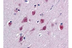 Image no. 1 for anti-Single-Strand-Selective Monofunctional Uracil-DNA Glycosylase 1 (SMUG1) (N-Term) antibody (ABIN372862) (SMUG1 抗体  (N-Term))