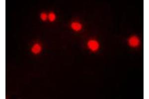 Immunofluorescent analysis of DYRK1A staining in HeLa cells. (DYRK1A 抗体  (N-Term))