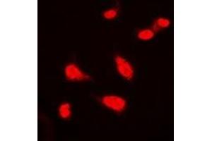 Immunofluorescent analysis of BAP1 staining in Hela cells. (BAP1 抗体)