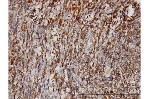 Immunostaining (ISt) image for anti-BCL2-Associated Athanogene (BAG1) (AA 241-345) antibody (ABIN560026)
