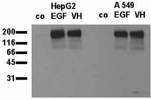 Phosphospecificity: Whole cell extracts of control (co), EGF stimulated (EGF) or pervanadate treated (VH) HepG2 and A549 tumor cells were applied to SDS-PAGE (20,000 cells per lane) and transferred to a PVDF membrane. (EGFR 抗体  (pTyr845))