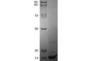 Validation with Western Blot (CXCL14 蛋白)