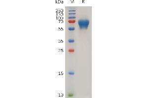 Leukemia Inhibitory Factor (LIF) (AA 23-202) protein (Fc Tag)