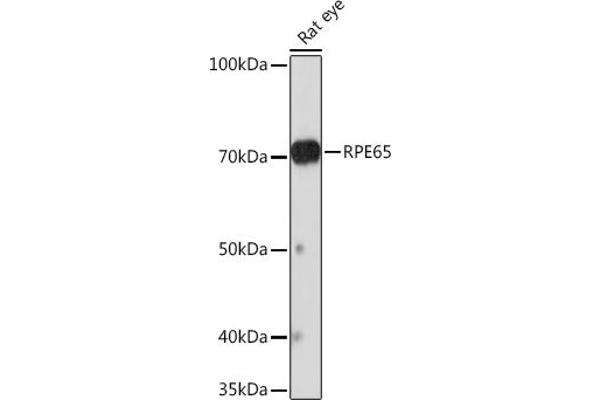 RPE65 抗体