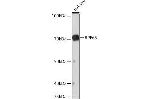 Western blot analysis of extracts of Rat eye, using RPE65 Rabbit mAb (ABIN7269933) at 1:1000 dilution. (RPE65 抗体)