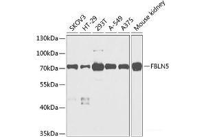 Western blot analysis of extracts of various cell lines using FBLN5 Polyclonal Antibody at dilution of 1:1000. (Fibulin 5 抗体)