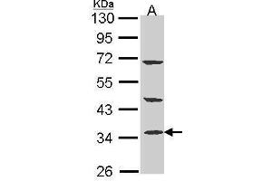 WB Image Sample (30 ug of whole cell lysate) A: A431 , 10% SDS PAGE antibody diluted at 1:1000 (PTER 抗体)