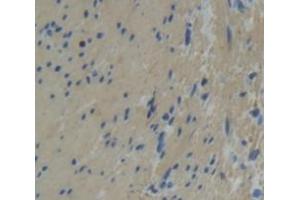 IHC-P analysis of Human Tissue, with DAB staining. (Tropomodulin 1 抗体  (AA 39-138))