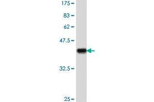 Western Blot detection against Immunogen (38. (CRCP 抗体  (AA 39-148))