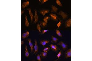 Immunofluorescence (IF) image for anti-Ribosomal Protein S17 (RPS17) (AA 1-100) antibody (ABIN7270016)