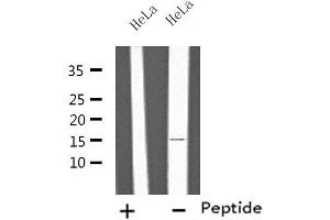 Western blot analysis of extracts from HeLa cells, using IL4 antibody. (IL-4 抗体  (Internal Region))