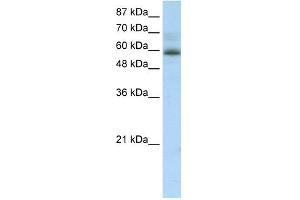 WB Suggested Anti-ZNF307 Antibody Titration:  2. (ZKSCAN4 抗体  (Middle Region))