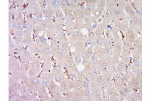 Immunohistochemistry (Paraffin-embedded Sections) (IHC (p)) image for anti-ATP-Binding Cassette, Sub-Family B (MDR/TAP), Member 11 (ABCB11) (AA 21-120) antibody (ABIN675848)
