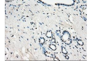 Immunohistochemical staining of paraffin-embedded Ovary tissue using anti-GBP2mouse monoclonal antibody. (GBP2 抗体)