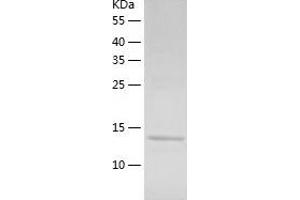 Ribosomal Protein, Large, P2 (RPLP2) (AA 1-115) protein (His-IF2DI Tag)
