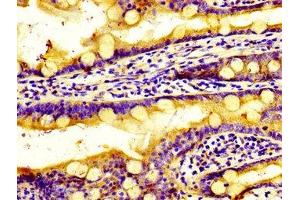 Immunohistochemistry of paraffin-embedded human small intestine tissue using ABIN7170569 at dilution of 1:100 (S1PR2 抗体  (AA 293-353))