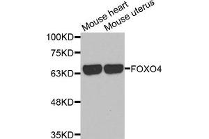 Western blot analysis of extracts of various cell lines, using FOXO4 antibody. (FOXO4 抗体  (AA 346-505))