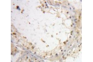 IHC-P analysis of Testis tissue, with DAB staining. (Interleukin enhancer-binding factor 3 (ILF3) (AA 672-891) 抗体)