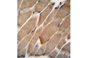 Formalin fixed and paraffin embedded human skeletal muscle reacted with ELMO2 Antibody  followed by peroxidase conjugation of the secondary antibody and DAB staining. (ELMO2 抗体  (Middle Region))