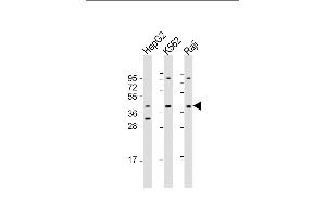 All lanes : Anti-FGFR1OP Antibody (Center) at 1:1000-1:2000 dilution Lane 1: HepG2 whole cell lysate Lane 2: K562 whole cell lysate Lane 3: Raji whole cell lysate Lysates/proteins at 20 μg per lane. (FGFR1OP 抗体  (AA 183-214))