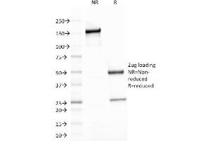 SDS-PAGE (SDS) image for anti-Spectrin, Beta, Non-erythrocytic 2 (SPTBN2) (AA 356-475) antibody (ABIN6940654)
