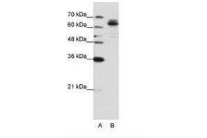 Image no. 1 for anti-Fragile X Mental Retardation, Autosomal Homolog 1 (FXR1) (AA 373-422) antibody (ABIN6736201) (FXR1 抗体  (AA 373-422))