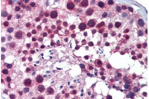 Immunohistochemistry (Formalin-fixed Paraffin-embedded Sections) (IHC (fp)) image for anti-Polo-Like Kinase 1 (PLK1) (C-Term) antibody (ABIN6747101)