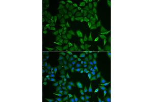 Immunofluorescence analysis of HeLa cells using CLPS antibody (ABIN2969055). (CLPS 抗体)