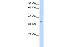 SC4MOL antibody used at 5 ug/ml to detect target protein. (SC4MOL 抗体  (N-Term))