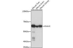 Western blot analysis of extracts of various cell lines, using F Rabbit mAb (ABIN1682600, ABIN3018533, ABIN3018534 and ABIN7101623) at 1:1000 dilution. (FAAH 抗体)