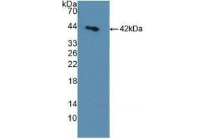 Detection of Recombinant SDH, Rat using Polyclonal Antibody to Sorbitol Dehydrogenase (SDH) (SORD 抗体  (AA 2-357))