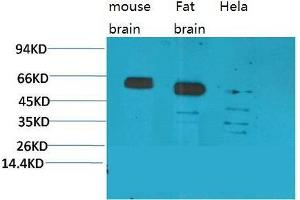 Western Blot (WB) analysis of 1) Mouse Brain Tissue, 2)Rat Brain Tissue, 3)Human Brain Tissue, with CCKBR Rabbit Polyclonal Antibody diluted at 1:2000. (CCKBR 抗体)
