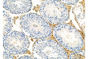 ABIN6265576 and ABIN6273176 at 1/100 staining Mouse testis tissue by IHC-P.