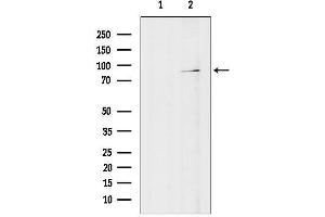 anti-Praja Ring Finger 2 (PJA2) antibody
