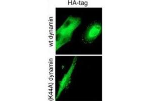 GTPase activity of Dynamin-2 is required for endocytosis of cell-surface tTG. (HA-Tag 抗体)