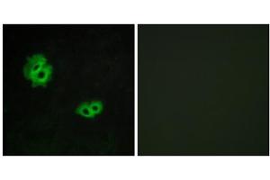 Immunofluorescence analysis of MCF-7 cells, using GPR171 antibody. (GPR171 抗体  (Internal Region))