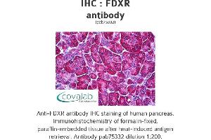 Image no. 1 for anti-Ferredoxin Reductase (FDXR) antibody (ABIN1734312) (Ferredoxin Reductase 抗体)