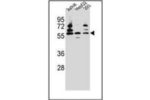 Western blot analysis of PDP1 Antibody (Center) in Jurkat,HepG2,293 cell line lysates (35ug/lane). (PDP 抗体  (Middle Region))
