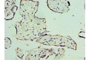 Immunohistochemistry of paraffin-embedded human placenta tissue using ABIN7159927 at dilution of 1:100 (SLC25A15 抗体  (AA 1-301))