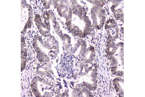 IHC analysis of DGCR8 using anti-DGCR8 antibody . (DGCR8 抗体  (AA 561-762))