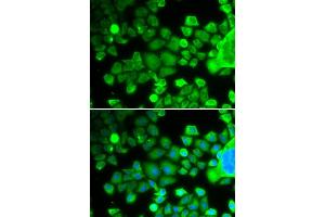 Immunofluorescence analysis of MCF-7 cells using RPS10 antibody (ABIN6132945, ABIN6147192, ABIN6147194 and ABIN6221686). (RPS10 抗体  (AA 1-165))