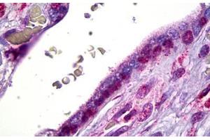 Anti-SMO antibody IHC staining of human placenta, cytotrophoblast. (SMO 抗体)