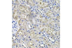 Immunohistochemistry of paraffin-embedded rat kidney using ACO1 antibody (ABIN5995389) at dilution of 1/100 (40x lens). (Aconitase 1 抗体)