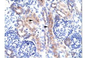 Image no. 1 for anti-RAR-Related Orphan Receptor A (RORA) (AA 50-99) antibody (ABIN202757) (RORA 抗体  (AA 50-99))