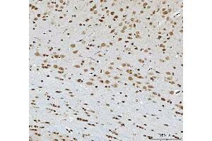 IHC analysis of THAP11 using anti-THAP11 antibody (ABIN7599230). (THAP11 抗体  (AA 1-294))