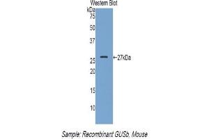 Detection of Recombinant GUSb, Mouse using Polyclonal Antibody to Glucuronidase Beta (GUSb) (Glucuronidase beta 抗体  (AA 451-648))