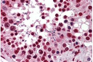 Immunohistochemistry (Formalin-fixed Paraffin-embedded Sections) (IHC (fp)) image for anti-KH-Type Splicing Regulatory Protein (KHSRP) (AA 151-240) antibody (ABIN574396)