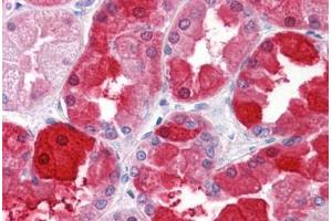Human Kidney: Formalin-Fixed, Paraffin-Embedded (FFPE) (CRYM 抗体  (AA 215-315))