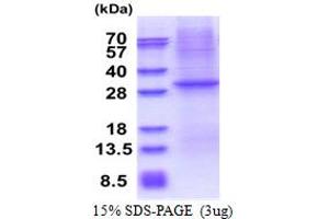 SDS-PAGE (SDS) image for CD1e (CD1e) (AA 32-305) protein (His tag) (ABIN5853610) (CD1e Protein (CD1e) (AA 32-305) (His tag))